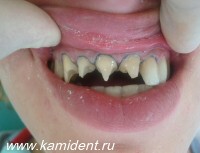 Увеличить ФОТО