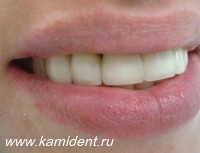 Увеличить ФОТО