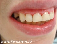 Увеличить ФОТО